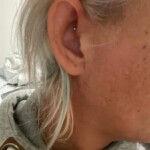 Piercinger af Kasper Gregersen fa en piercing i Kobenhavn eller Marbella 14